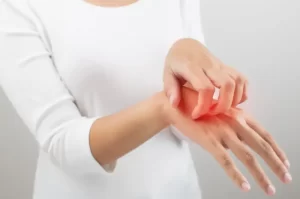 25 Effective Home Remedies To Treat Body Rashes