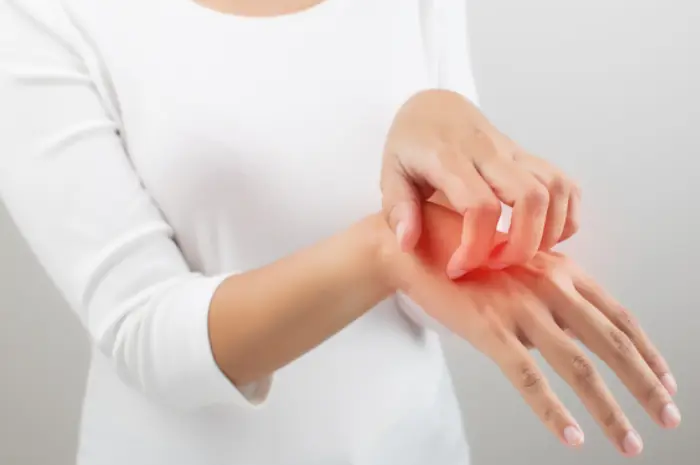 25 Effective Home Remedies To Treat Body Rashes