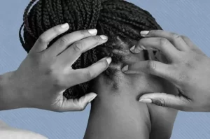 7 Easy Ways To Reduce Pimples On The Head