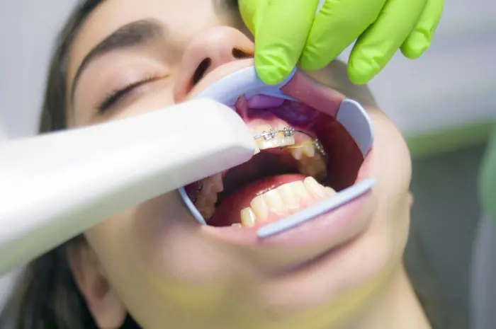 Reduces tooth sensitivity